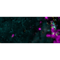 This image shows a costaining of T cells (cyan) expressing the chemokine CCL5 (yellow), which reside at a site of resolved virus infection (pink).  UNIGE