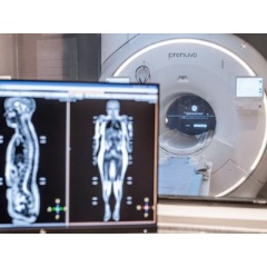 What Is the Prenuvo Whole-Body Scan?
