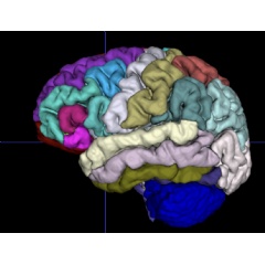 3D rendering of color-coded brain MRI segmentation from one of the 10,134 brain MRI scans analyzed in the study.