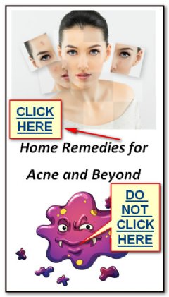 Home Remedies for Acne