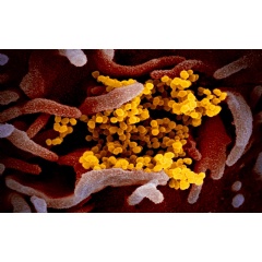 The novel coronavirus as seen under a microscope. Courtesy of the National Institutes of Health.