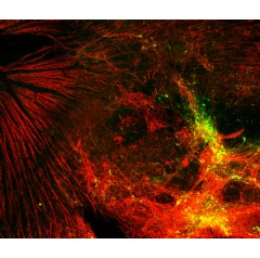 Stem cells on the retinal surface by 2 weeks post transplantation. Credit: Molecular Therapy - Methods and Clinical Development.