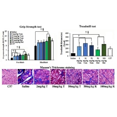 Effect of one year of tamoxifen and raloxifene treatment on muscle function (by grip strength and treadmill exercise) and fibrosis by Masson’s trichrome staining of tibialis anterior muscle (Tan and T, Tamoxifen; Ral and R, Raloxifene).