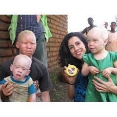Mafalda Soto, co-founder of Beyond Suncare, distributes the sunscreen developed in partnership with BASF to people with albinism in Malawi. ©Beyond Suncare