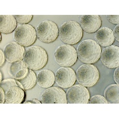 A microscopic image of cultured cells adhered to the PVA hydrogel microcarriers