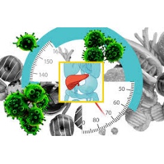 Caption:A new study from MIT reveals how a high-fat diet rewires liver cells and makes them more susceptible to becoming cancerous.
Credit: Christine Daniloff, MIT; iStock
