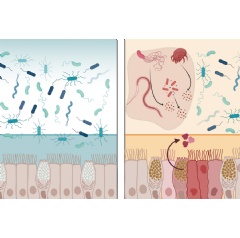 Caption:“What’s remarkable is that intelectin-2 (mltln2) operates in two complementary ways. It helps stabilize the mucus layer, and if that barrier is compromised, (see complete caption below)