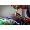 Caring for non-communicable diseases during pregnancy, expert convening