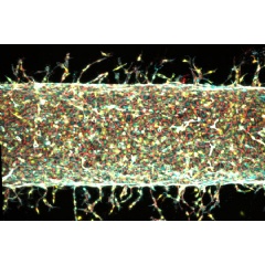 With mechanical stretching, MIT engineers can control how artificial arteries sprout new capillaries.
Courtesy of the researchers