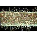 MIT engineers find a precise way to grow artificial blood vessels