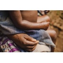 Children account for half of suspected mpox cases in Guinea-Bissau