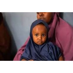 UNICEF/UN0910308/Sewunet
Mogadishu, Somalia, August 2026: Maida Abdullahi, 18 months old, looks towards the camera in Deyniile District, Mogadishu. She is pictured during a visit to Deyniile District Hospital,(see complete caption below)