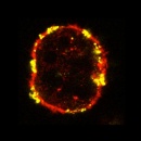 How to Teach T Cells to Track Cancer Like a Hound Dog