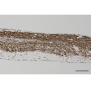 Mitsui Chemicals Launches InnoCell� P-Type High Oxygen-Permeable Culture Plates to Accelerate Organoid-Based Drug Discovery