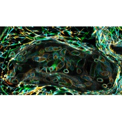 The parasitic worm that causes schistosomiasis hatches in water, and its larvae mature in a freshwater snail, as shown here. Photo: Bo Wang and Phillip A. Newmark, University of Illinois at Urbana-Champaign, 2013 FASEB BioArt winner