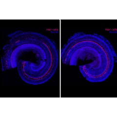 These images show cellular regeneration, in pink, in a preclinical model of sensorineural hearing loss. The control is on the left and the right has been treated.
Credits:
Image: Hinton AS, Yang-Hood A, Schrader AD, Loose C, Ohlemiller KK, McLean W