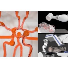 MIT engineers developed a telerobotic system to help surgeons remotely treat patients experiencing stroke or aneurysm.
Credits:

Credits:
Courtesy of the researchers