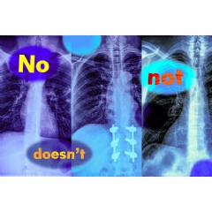 MIT researchers found that vision-language models, which are widely used to analyze medical images to streamline diagnosis, do not understand negation words like �no� and �not.�
Credits:
Image: iStock; MIT News