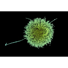A new study identifies genetic modifications that make “natural killer” cells more effective at destroying cancer cells.
Credit: NIAID