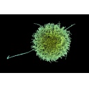 Engineered natural killer cells could help fight cancer