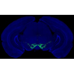 Image by Nicolas Tritsch [Fluorescence microscopy image of dopamine-producing neurons (green) in the midbrain of a mouse].