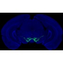 New evidence challenges understanding of Parkinson’s disease