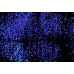 MIT researchers have developed a method for imaging neuron activity in the zebrafish brain. Each colored spot (green and yellow) represents an active neuron.
Credit: Courtesy of the researchers