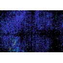 High-speed microscopy reveals electrical activity across the brain