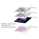 Nikon’s Spatial Omics Analysis Software Technology to be Utilized in Joint Research on Breast Cancer Metastasis Led by the University of Tokyo